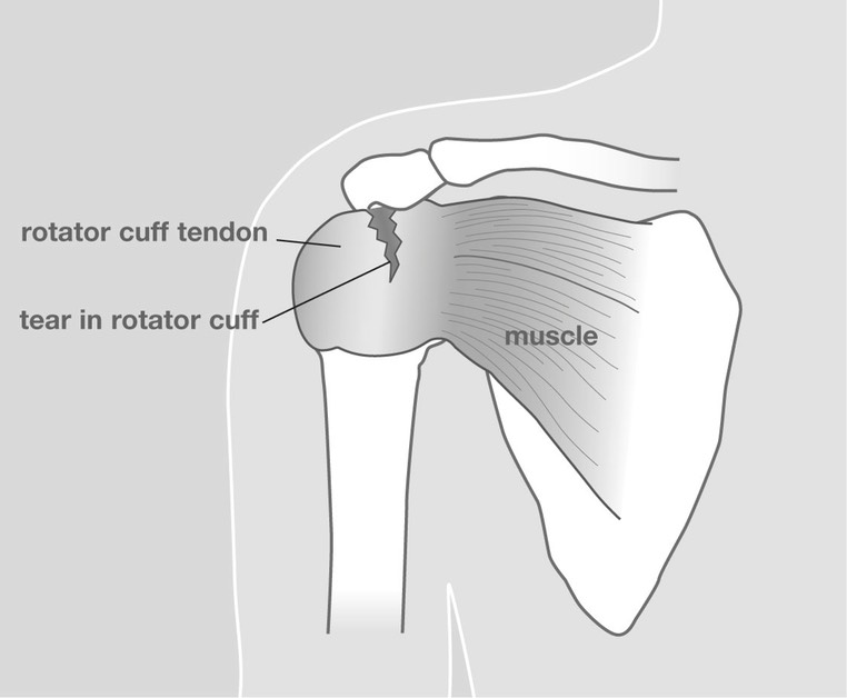 Rotator_Image2